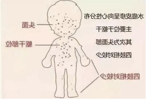 为什么冬季是高发季节